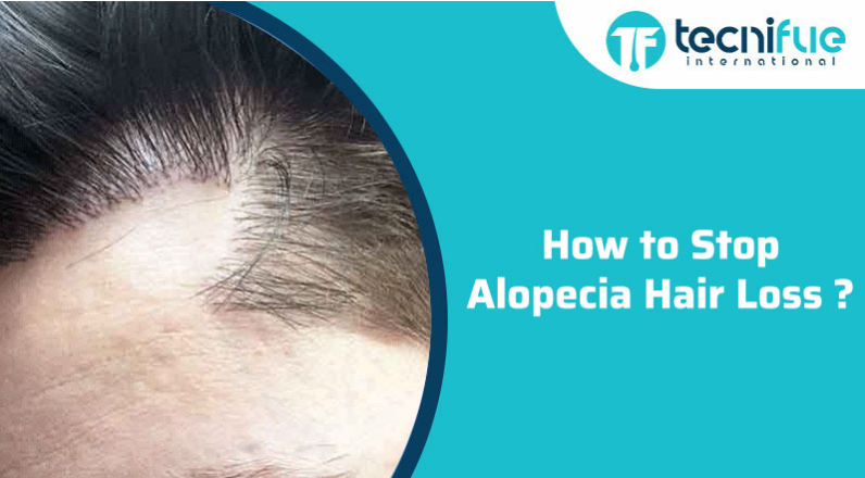  How to stop hair loss after covid