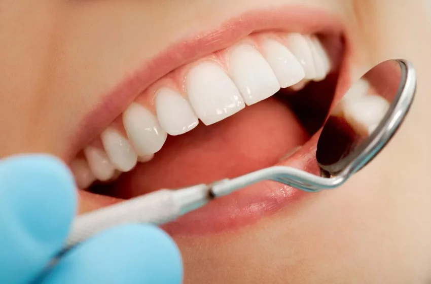  How To Prevent Dental Cavities?