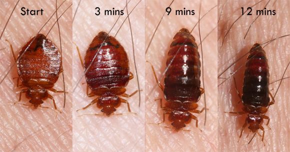  Should I Contact a Pest Control Company If I Have Bed Bugs?